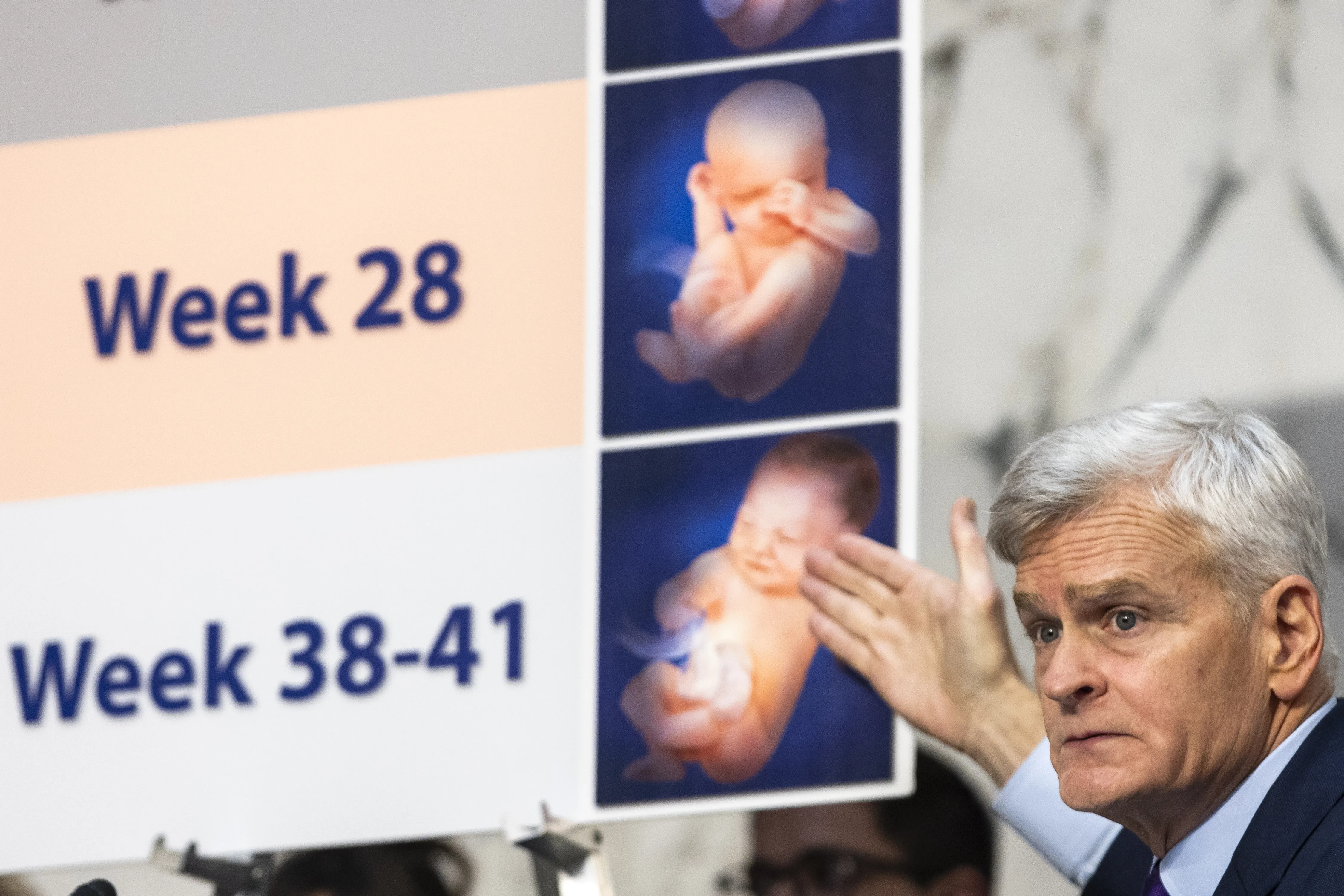 Ranking Member Sen. Bill Cassidy, R-Louisiana, speaks about the development of a preborn baby during a Senate Committee on Health hearing titled "The Assault on Women's Freedoms: How Abortion Bans Have Created a Health Care Nightmare Across America" on Capitol Hill on June 4, 2024, in Washington, D.C.?w=200&h=150